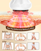 Body Sculpting Cellulite Massager with Heat, Light & Vibration – Rechargeable Lymphatic Massage Tool