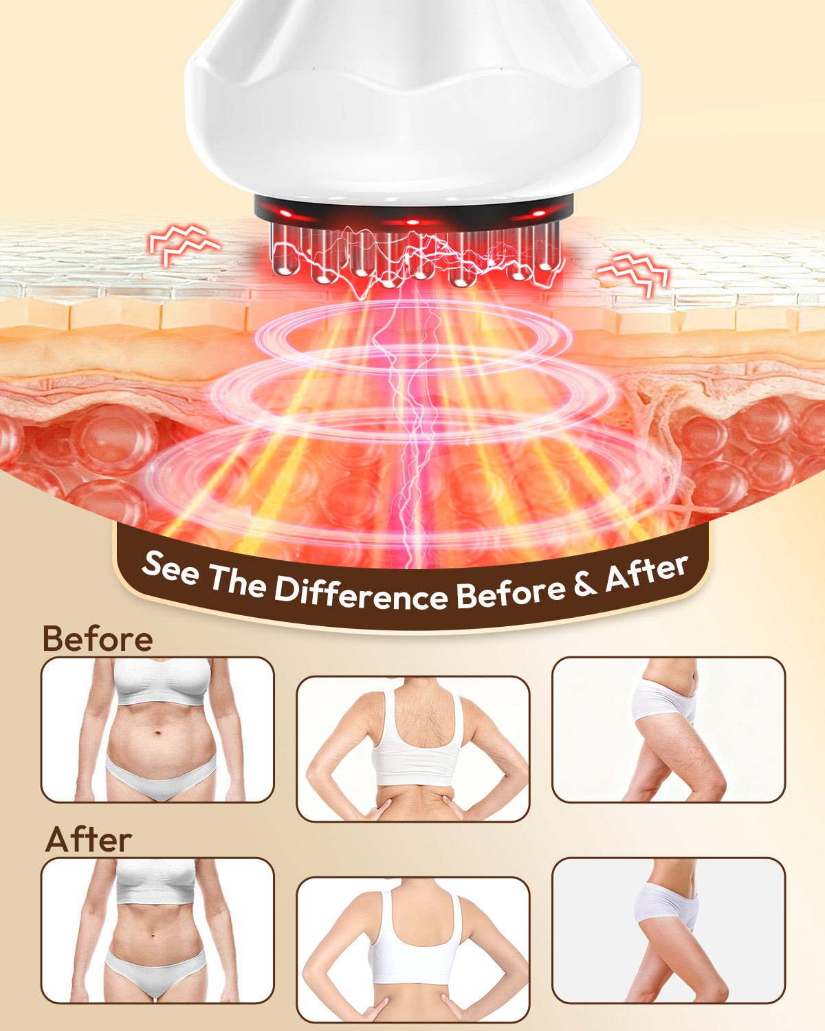 Body Sculpting Cellulite Massager with Heat, Light & Vibration – Rechargeable Lymphatic Massage Tool